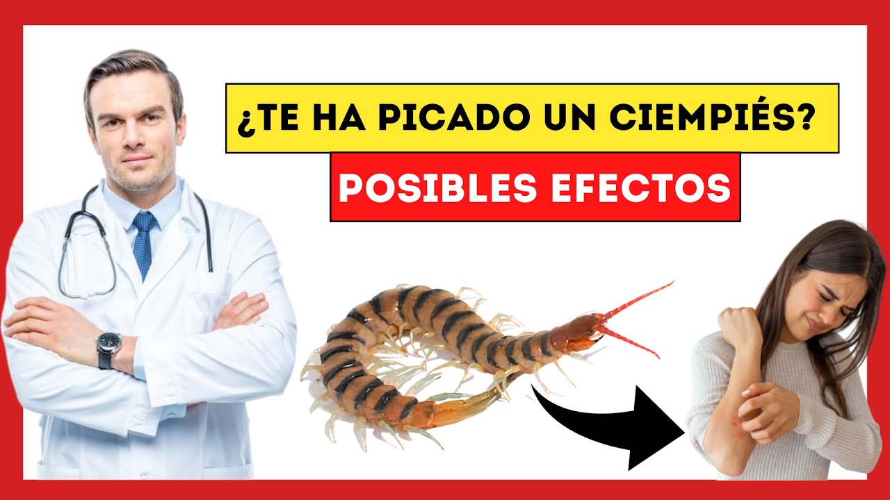 😱¿Qué Pasa si te PICA un Ciempiés? [Consecuencias Graves por PICADURA!!]