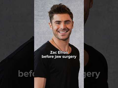 Zac Efron before and after jaw surgery #zacefron #shorts