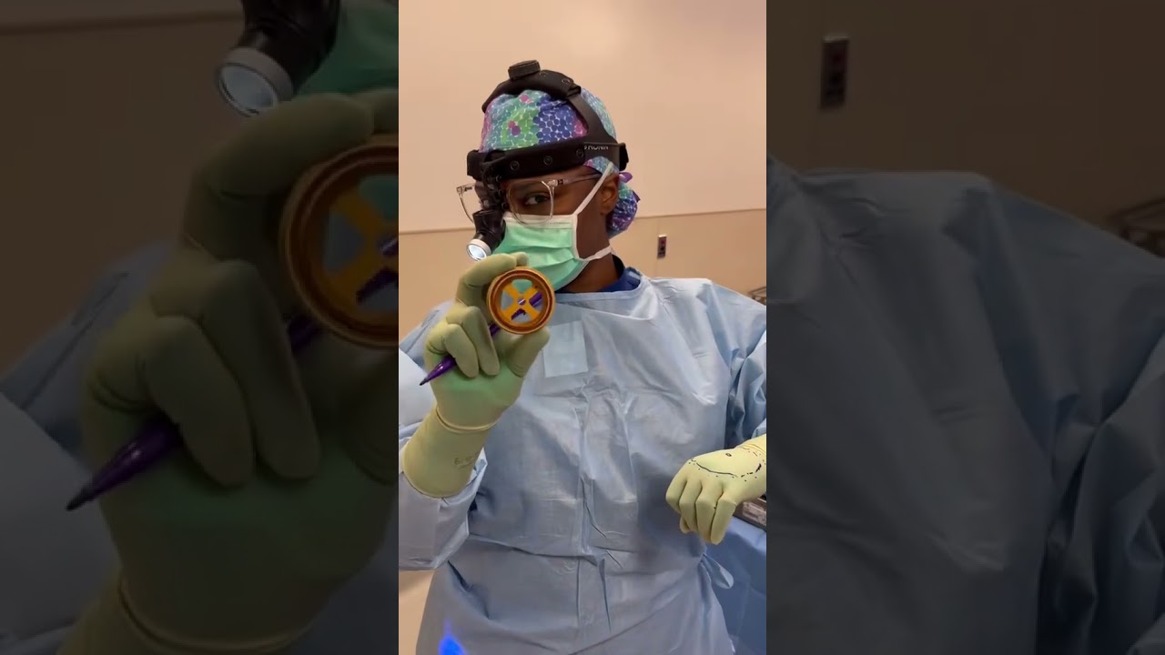 Reducing Areola Size in Breast Reduction / Lift