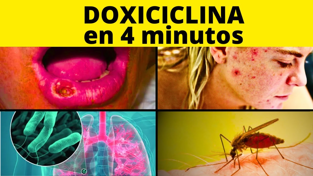 🦠 DESCUBRE Para Qué sirve la DOXICICLINA 100 mg en adultos y mucho más...