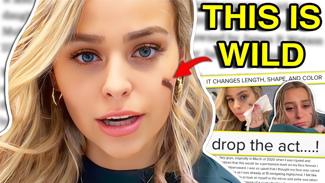 TIK TOK SCAR GIRL GOES VIRAL FOR LYING?! (but is she actually …)