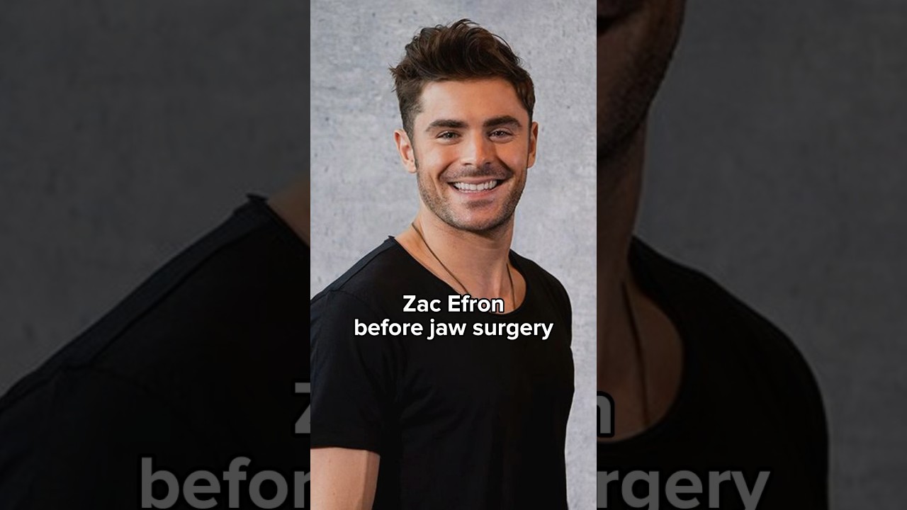 Zac Efron before and after jaw surgery #zacefron #shorts
