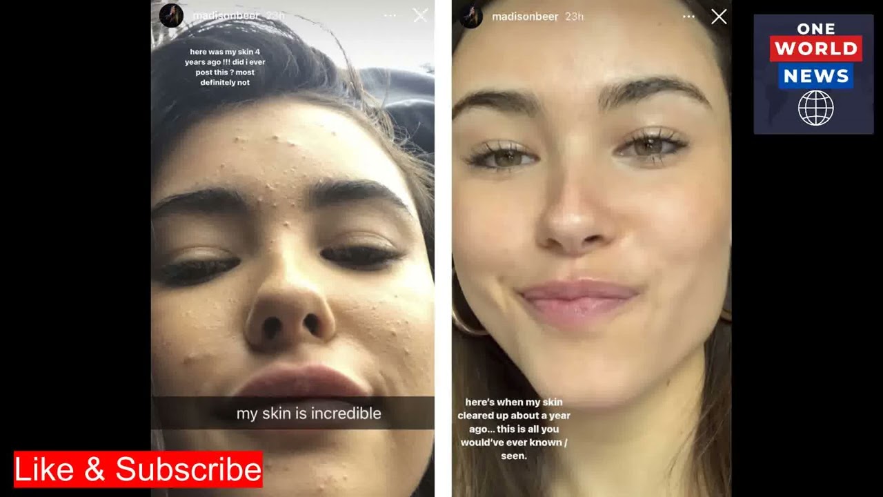 WATCH Madison Beer Leaked Video At 15, Madison Recalls Aftermath Of Leaked Videos With Boyfriend