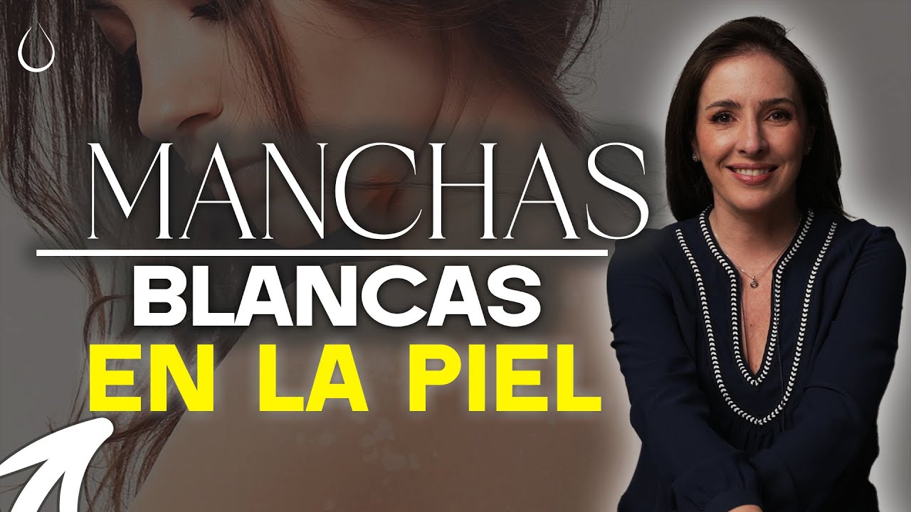 Manchas Blancas En La Piel: Causas y Soluciones @drapilarochoa - Dermatologa