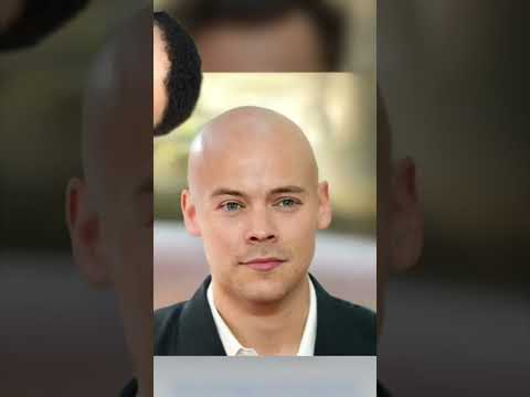 Harry Styles might be bald?? 👨🦲