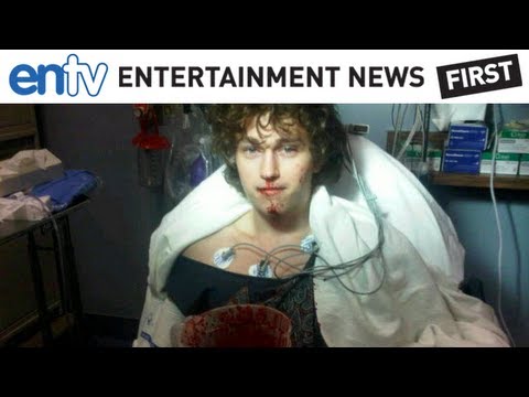 Miley Cyrus Brother Hospitalized: Braison Chance Suffers Blood Loss After Tonsils Removed