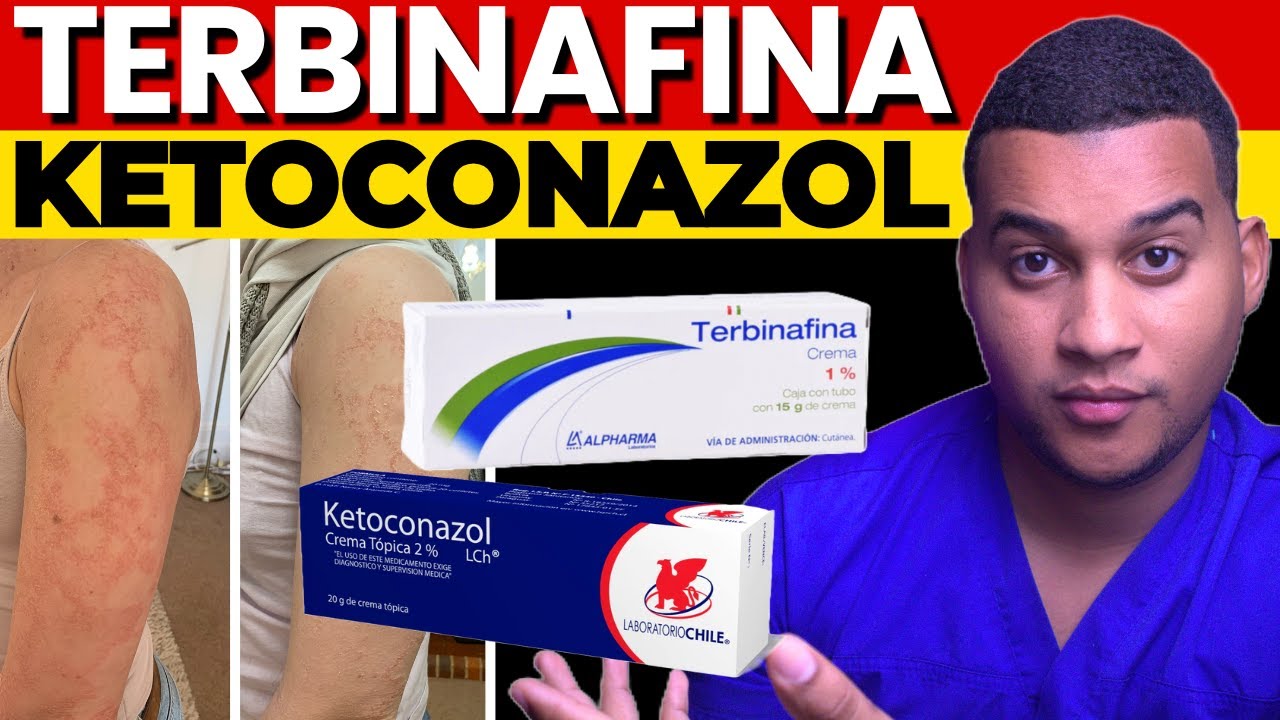 TERBINAFINA vs KETOCONAZOL ✅ ¿Cuál elimina mejor los hongos?