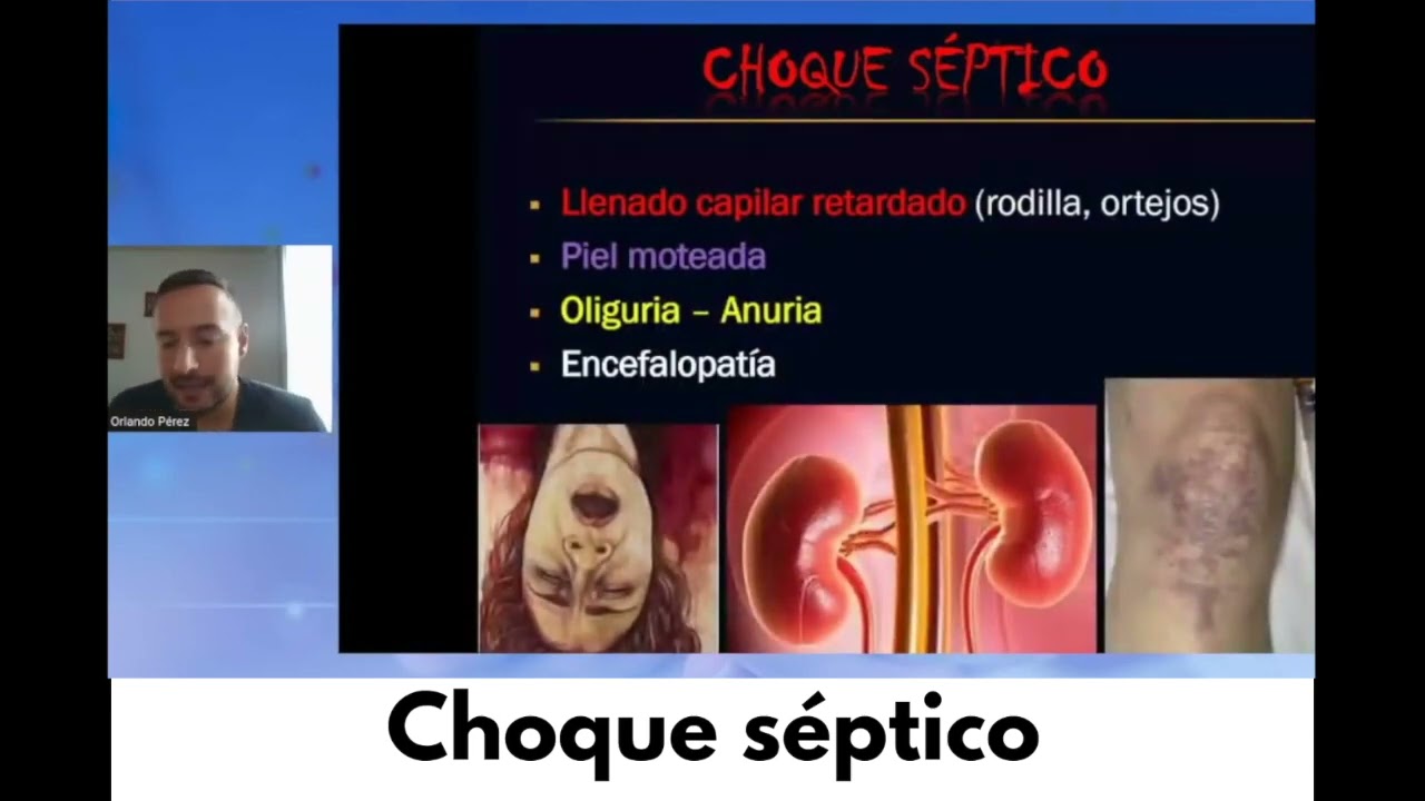 📎 Choque séptico: definición y fisiopatología