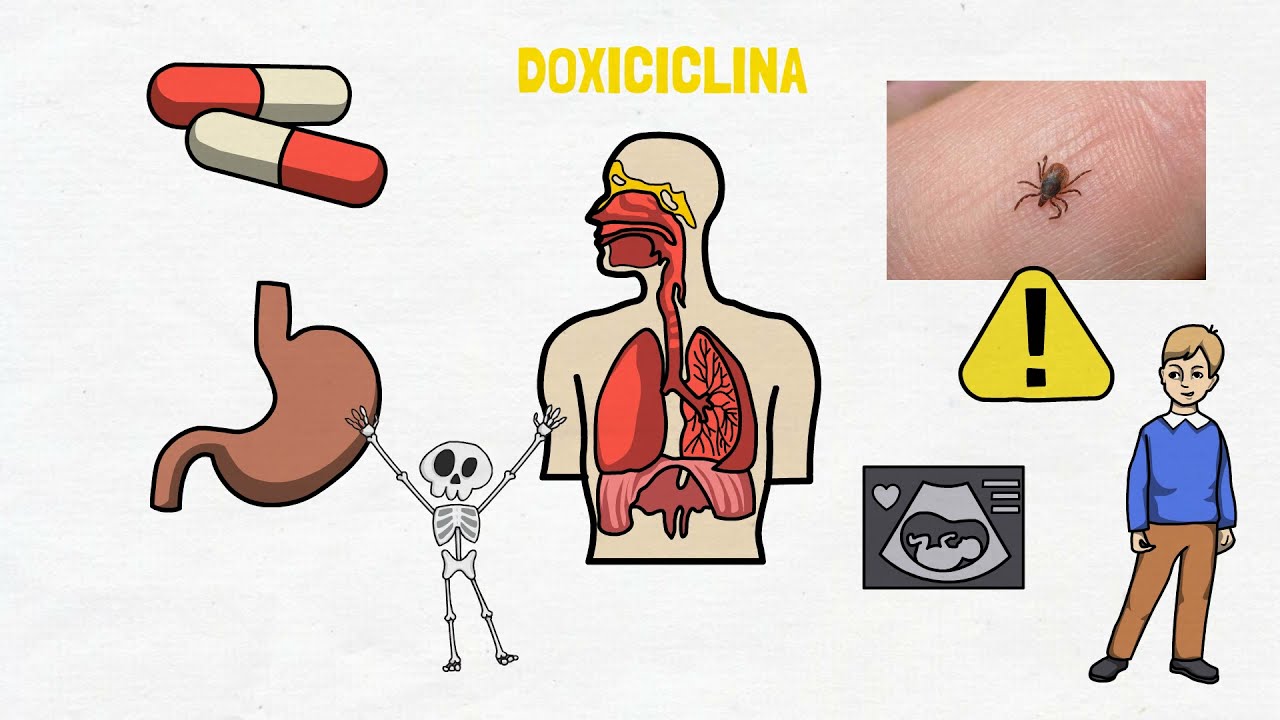 DOXICICLINA | PARA QUÉ SIRVE?