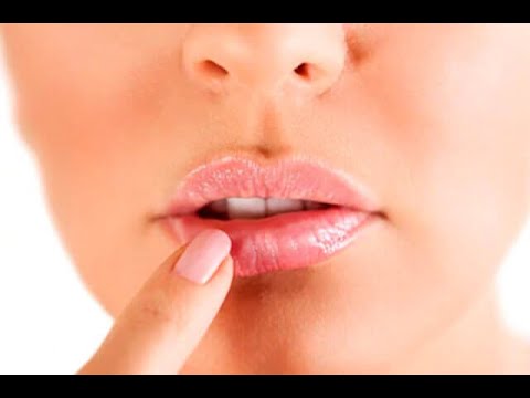 Fuegos o herpes labial, ¿por qué aparecen y cómo curarlos? | Noticias Caracol