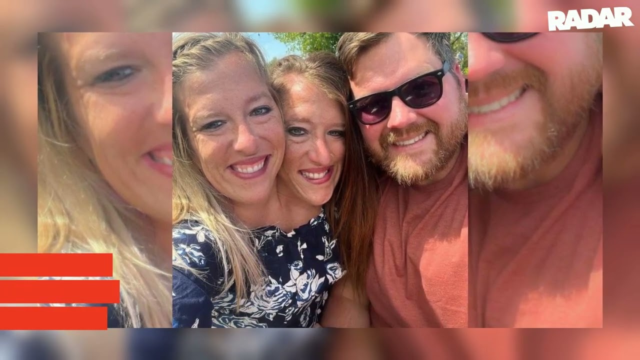 Conjoined Twin Abby Hensel's Husband Josh Bowling Slapped With Paternity Lawsuit Two Years After Sec