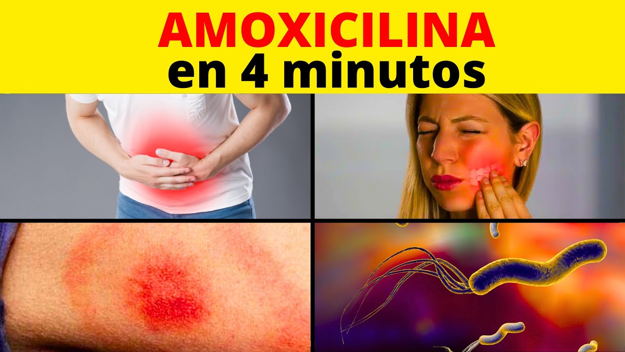 ☢️ AMOXICILINA con ÁCIDO CLAVULÁNICO: Para Qué Sirve, Cómo se toma y sus Efectos Secundarios