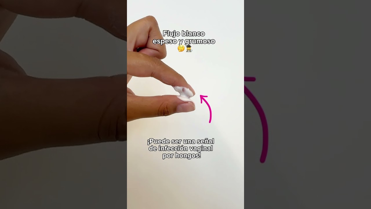 ¿Ya conocías los dos tipos de flujo blanco que existen? #nosotras