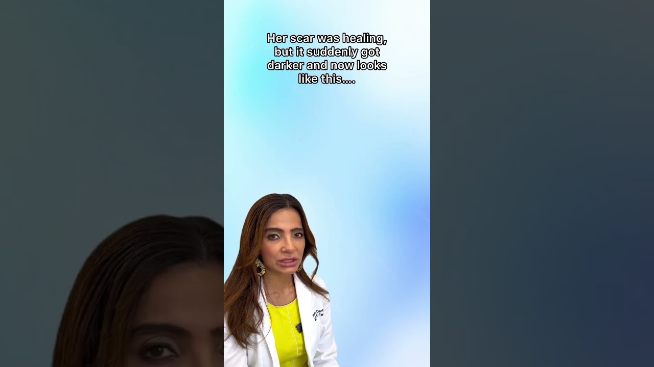 DERMATOLOGIST REACTS TO VIRAL TIKTOK "SCAR GIRL"