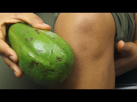 This is the reason why you should put avocado on your knee