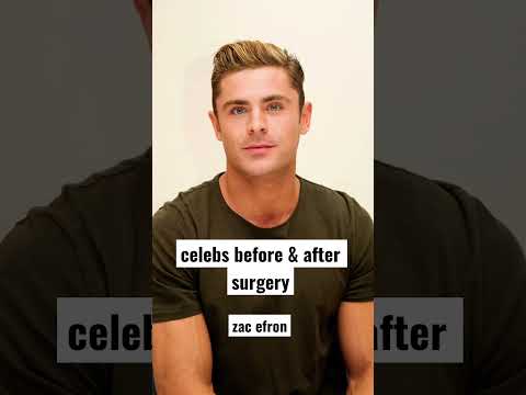 celebs before & after surgery | zac efron